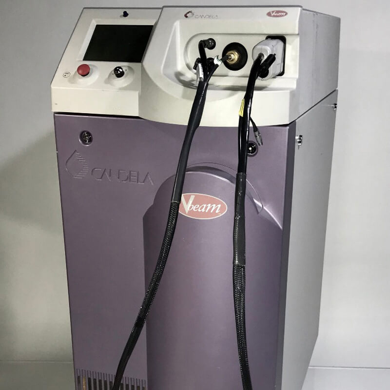 CANDELA VBEAM