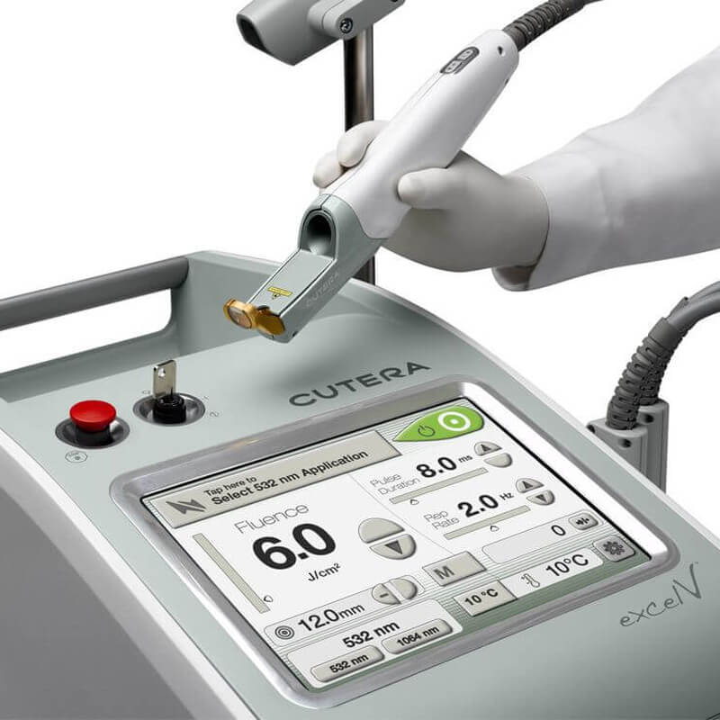 CUTERA EXCEL V