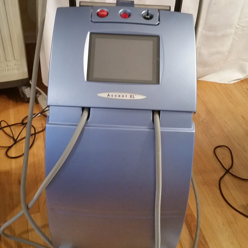 ALMA ACCENT XL